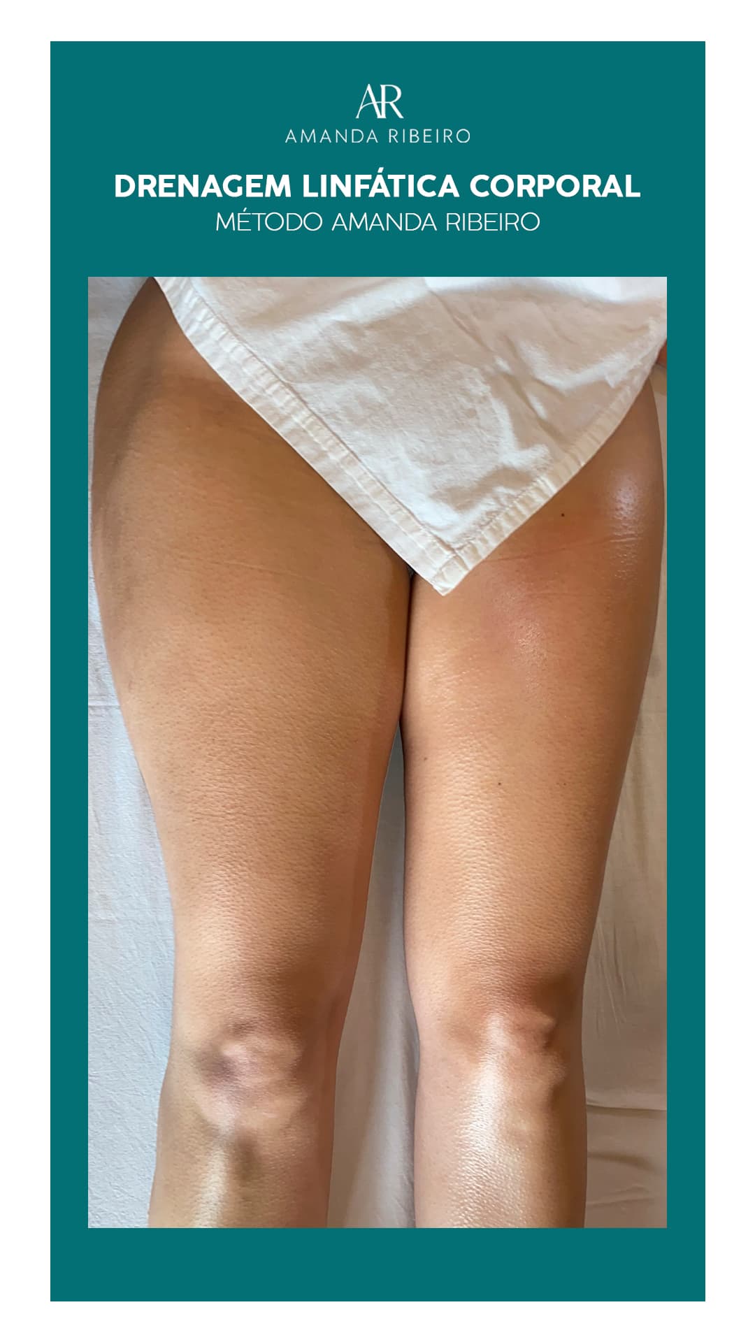 Resultado antes e depois - Drenagem Linfática