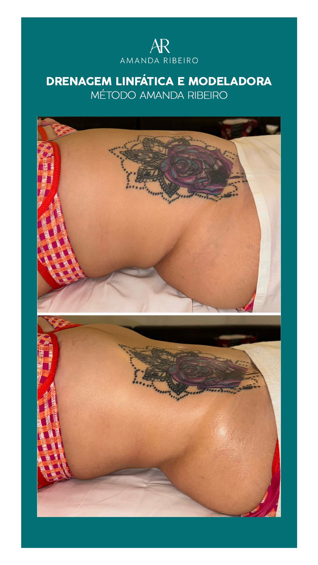 Resultado antes e depois - Drenagem Modeladora