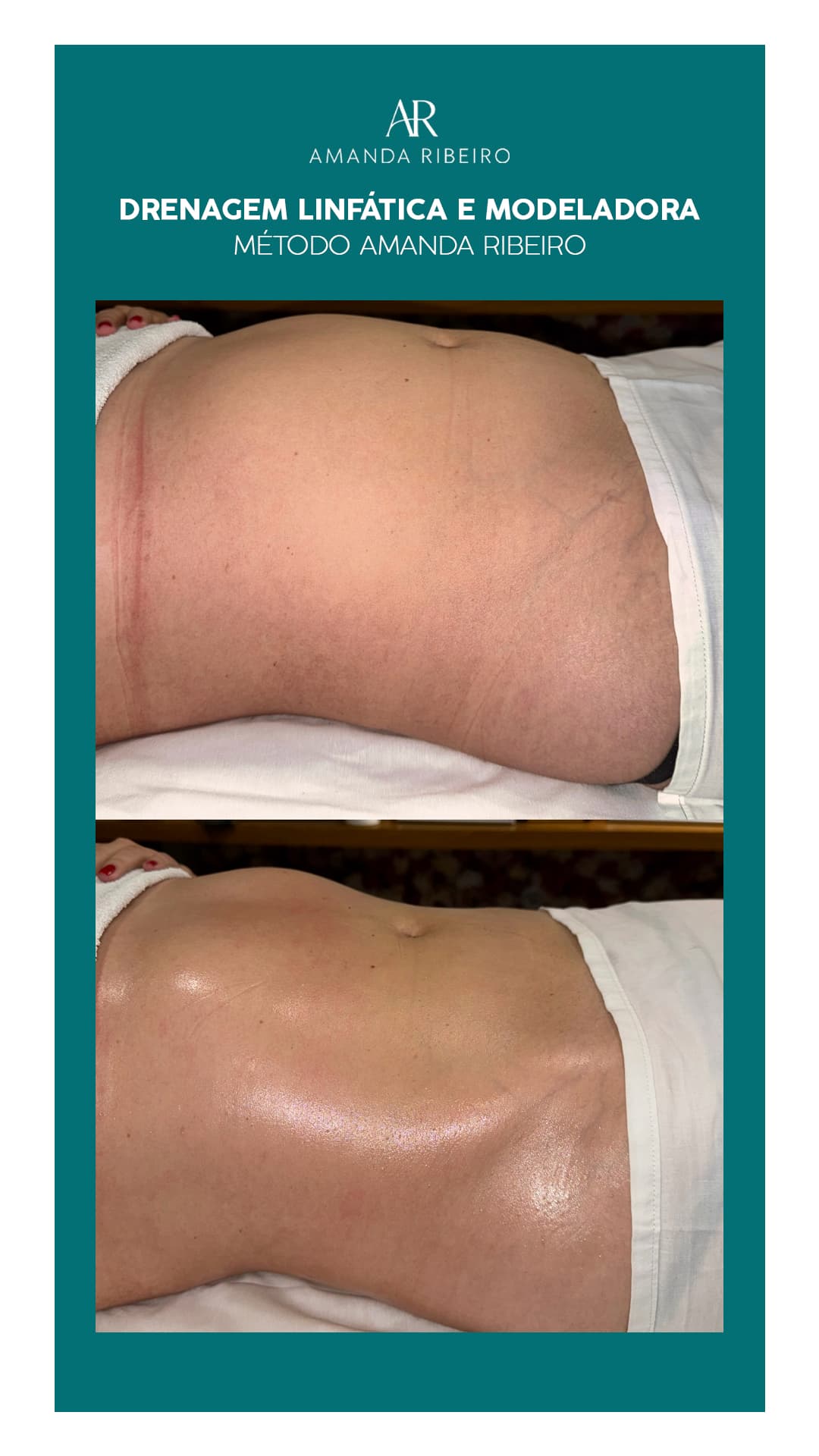 Resultado antes e depois - Drenagem Modeladora