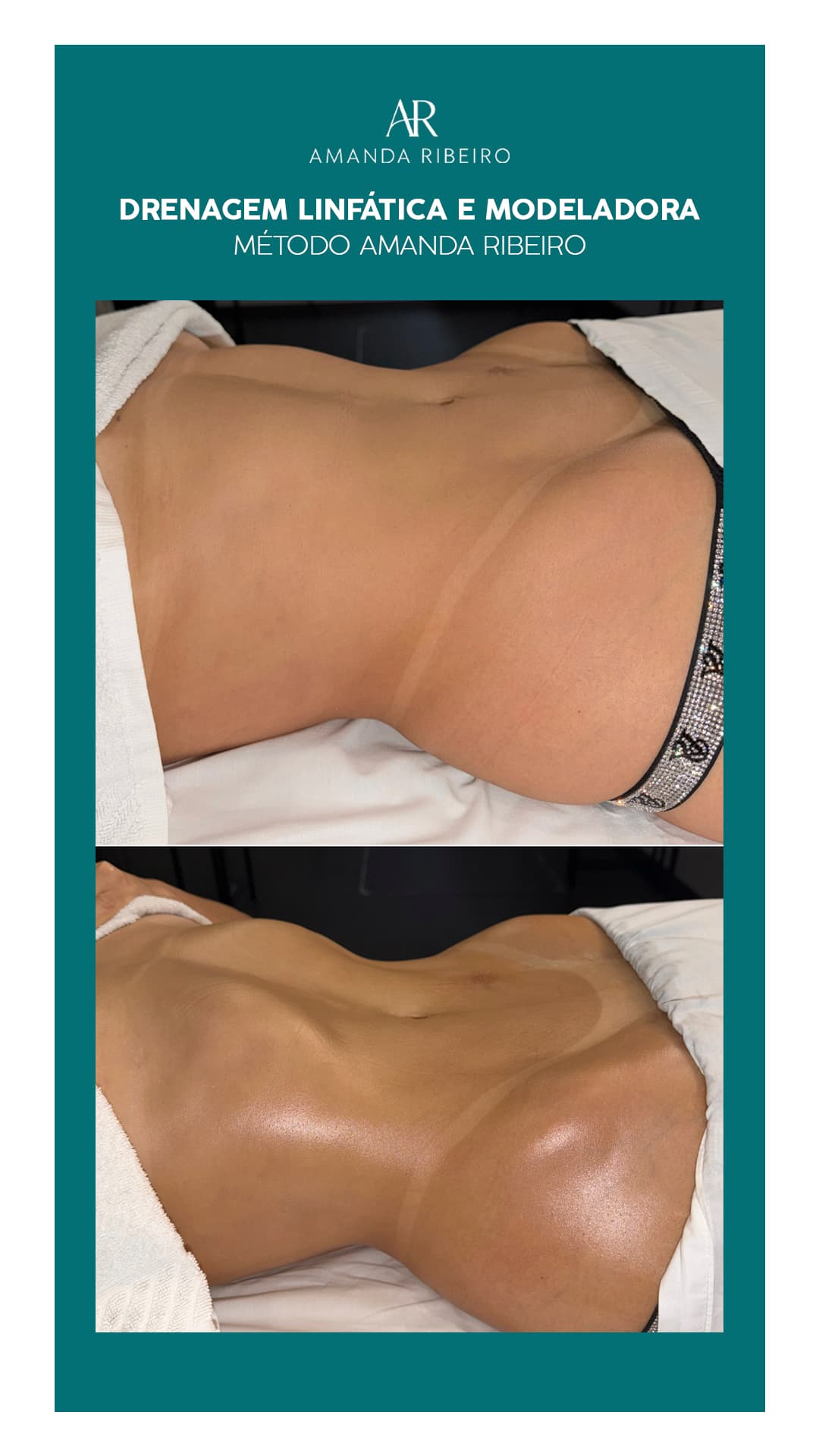 Resultado antes e depois - Drenagem Modeladora