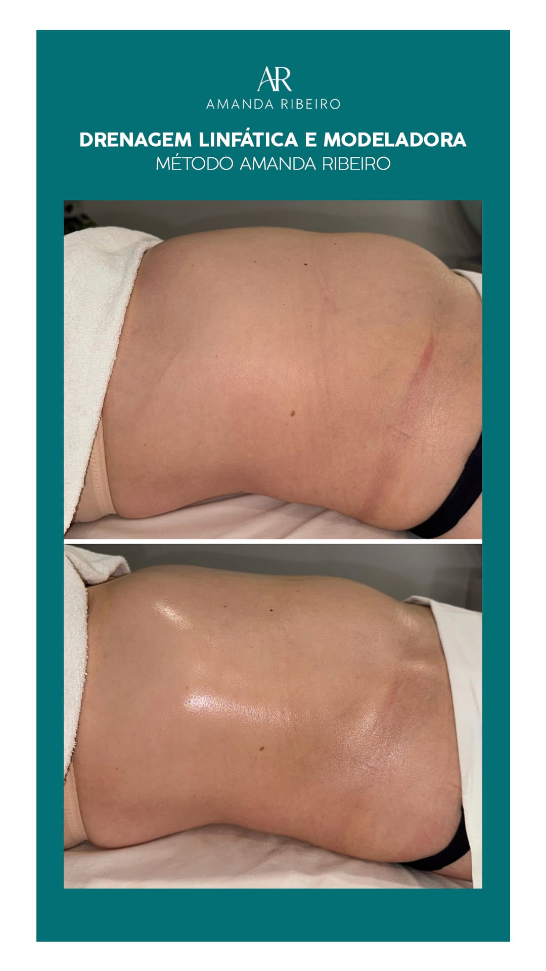 Resultado antes e depois - Drenagem Modeladora