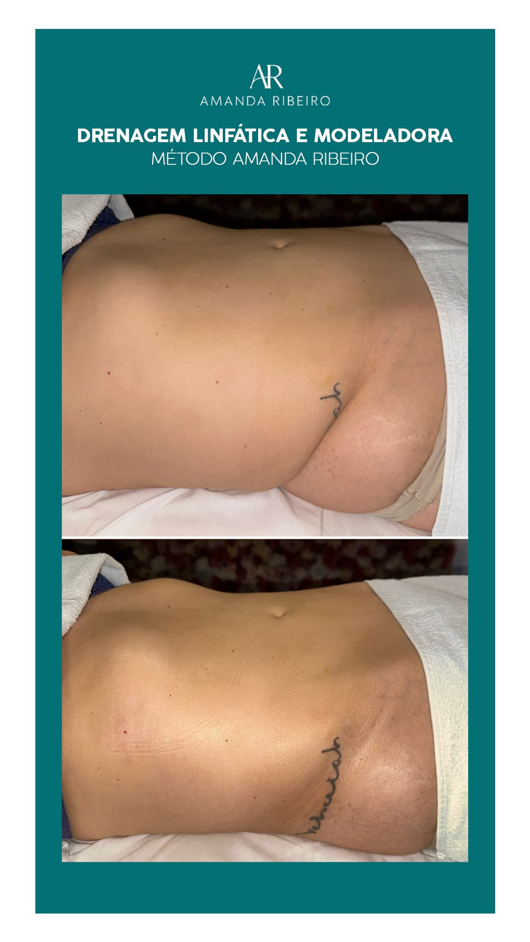 Resultado antes e depois - Drenagem Modeladora